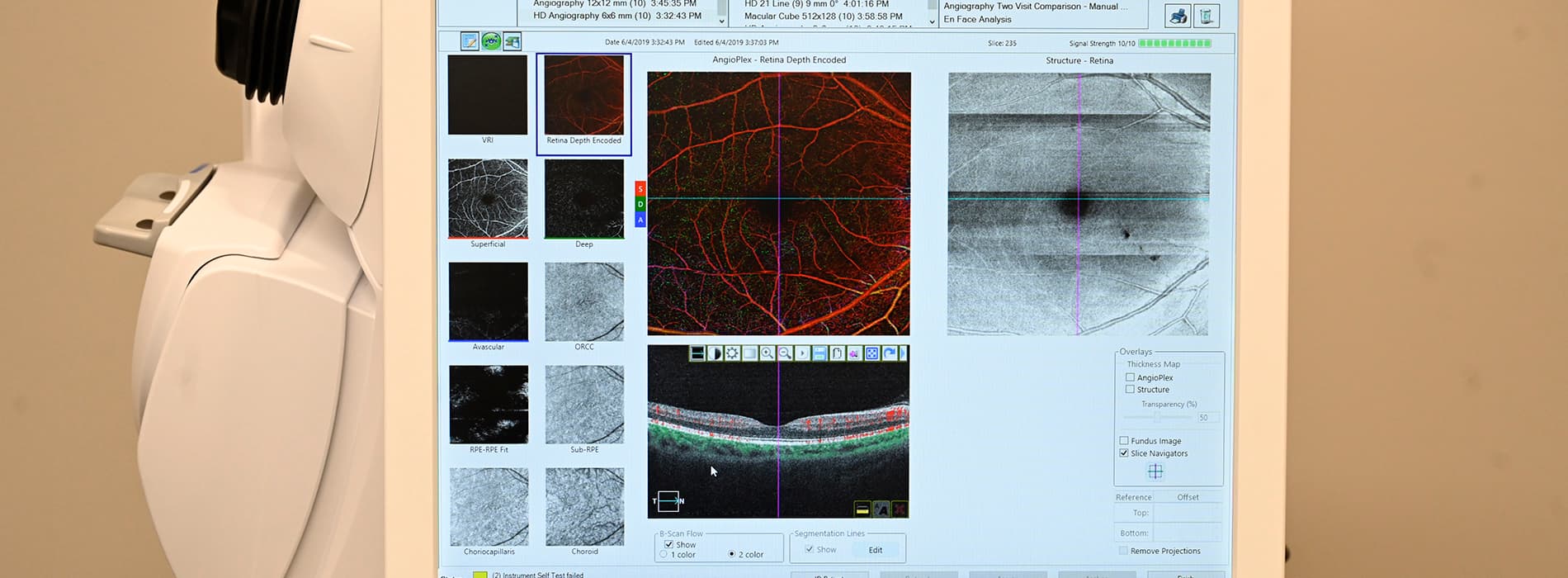 eye exam software